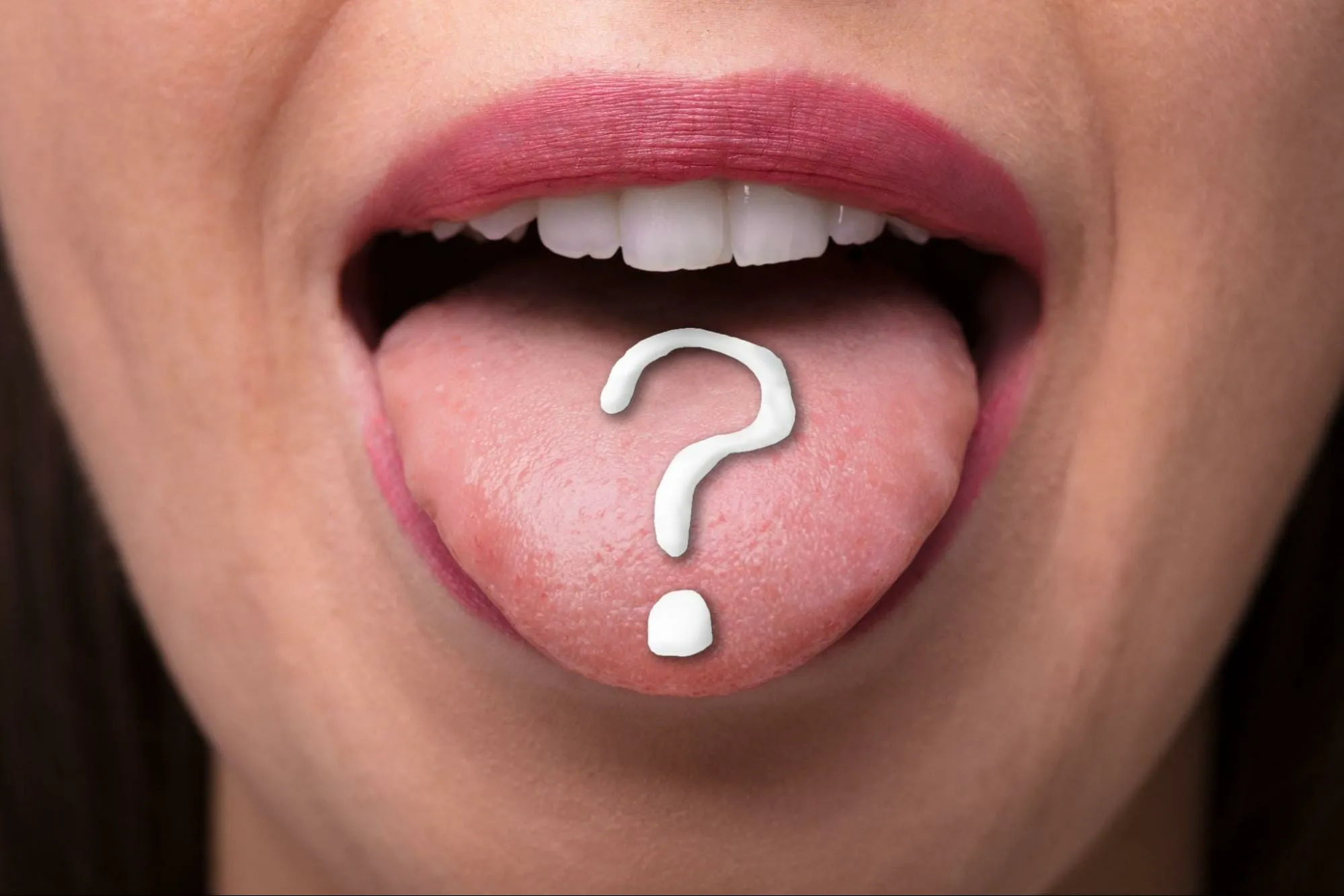 Dark Black Spots on the Tongue 1