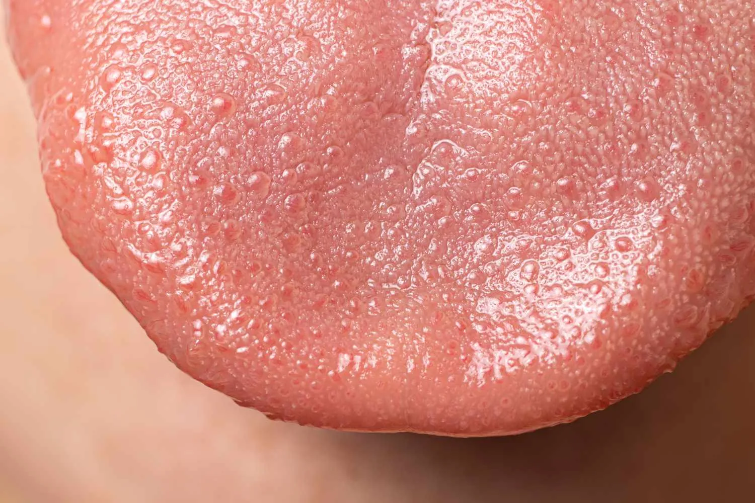 Tongue