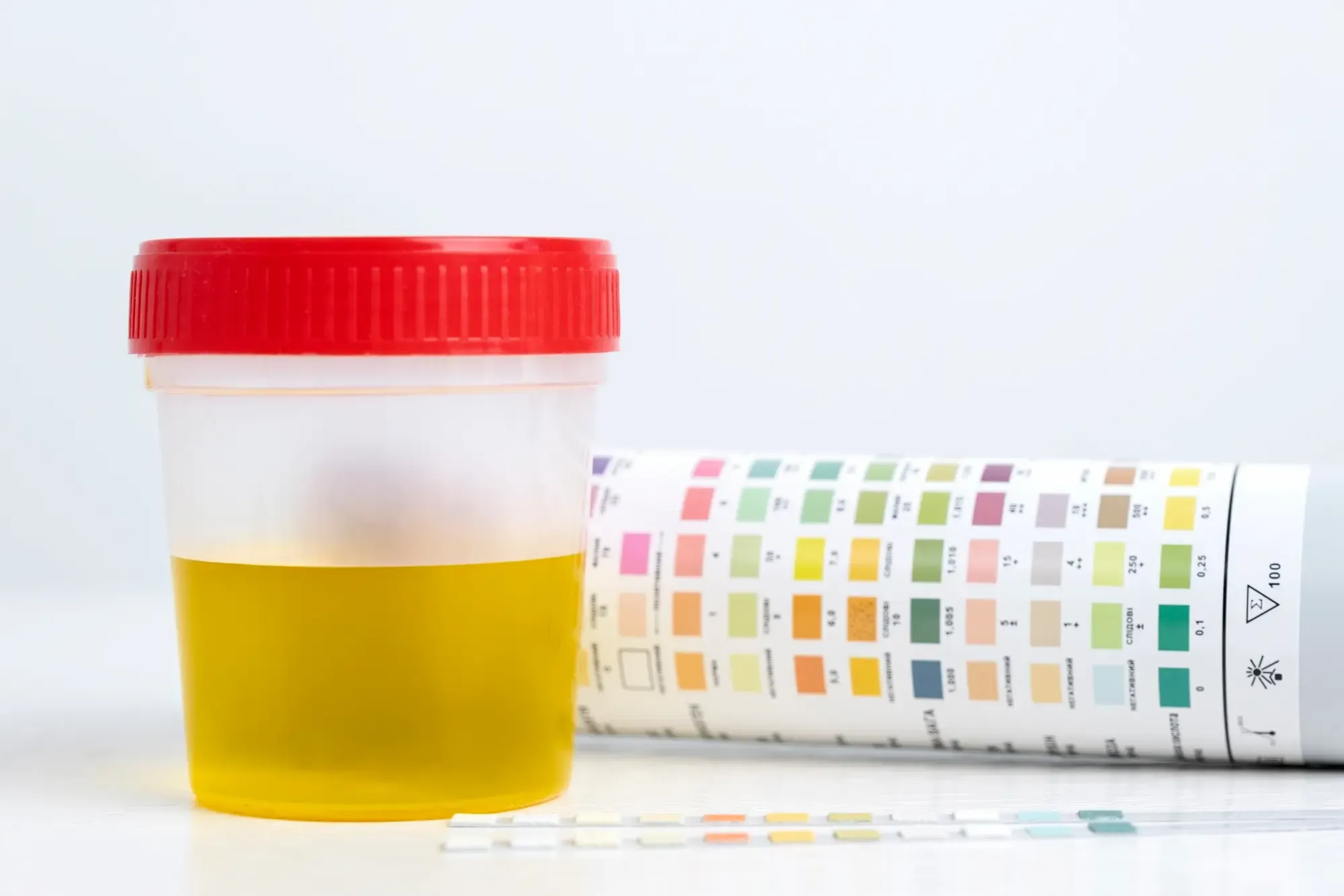Urine test