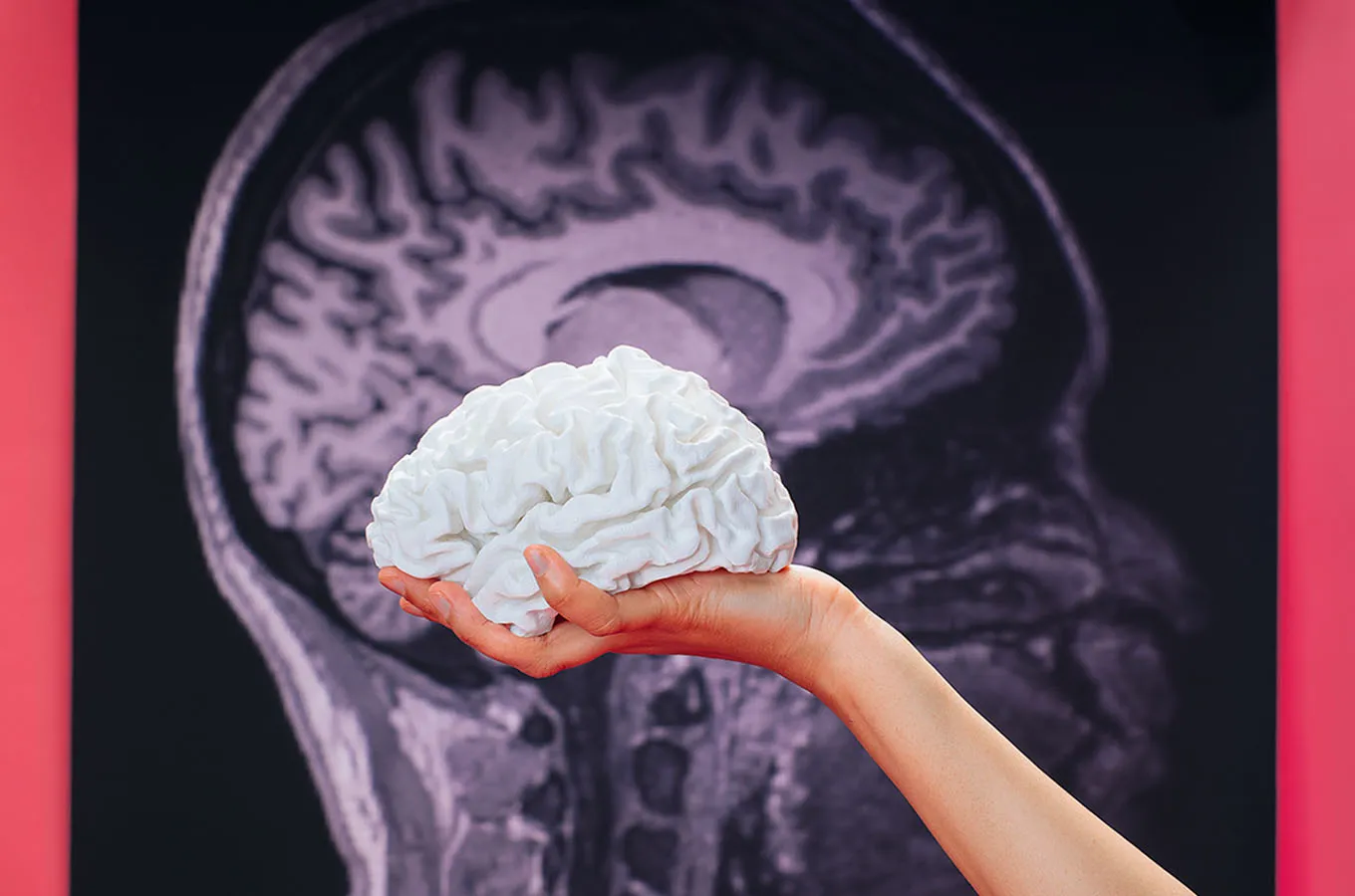 brain 1