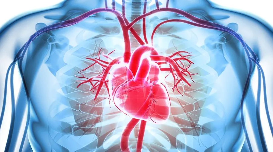 heart attack 3