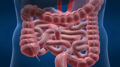 5 توصیه ساده و علمی برای داشتن روده ای سالم 6 5 توصیه ساده و علمی برای داشتن روده ای سالم 1