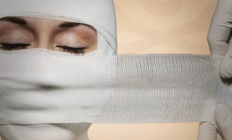 اسیدپاشی