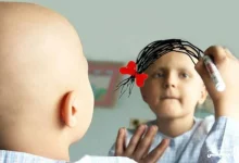 سرطان در کودکان