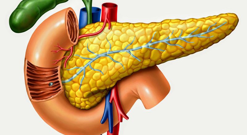 سرطان پانکراس