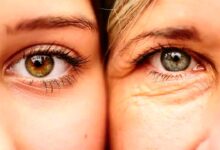 از بین بردن چروک