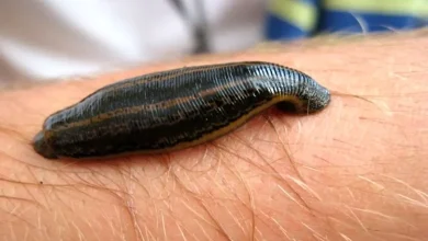 25 نشانه و تعبیر دیدن زالو در خواب2