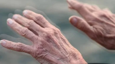 3 دلیل اصلی ابتلا به پارکینسون را بشناسیم