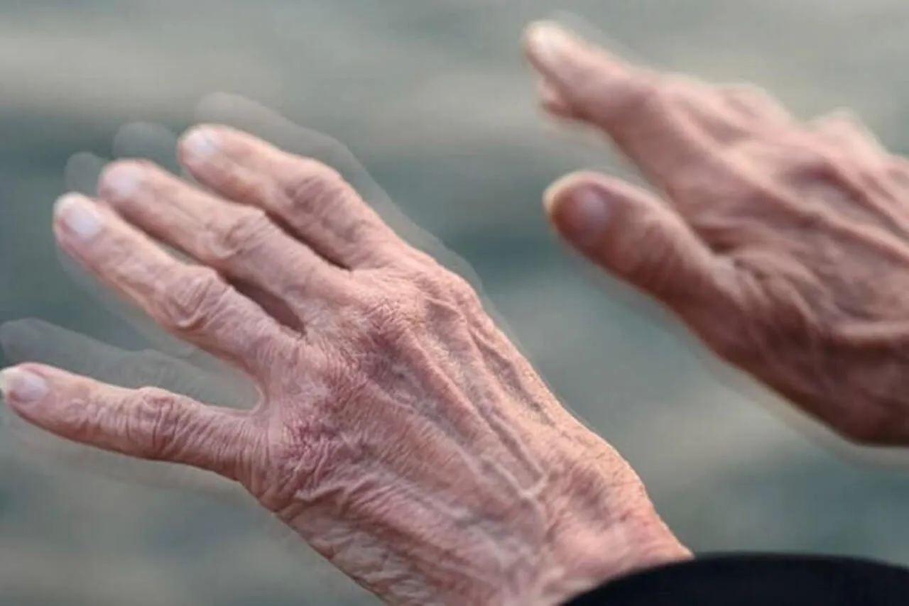 3 دلیل اصلی ابتلا به پارکینسون را بشناسیم 1 3 دلیل اصلی ابتلا به پارکینسون را بشناسیم