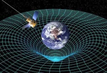 سندروم داون