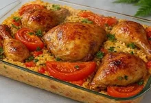 سندروم داون