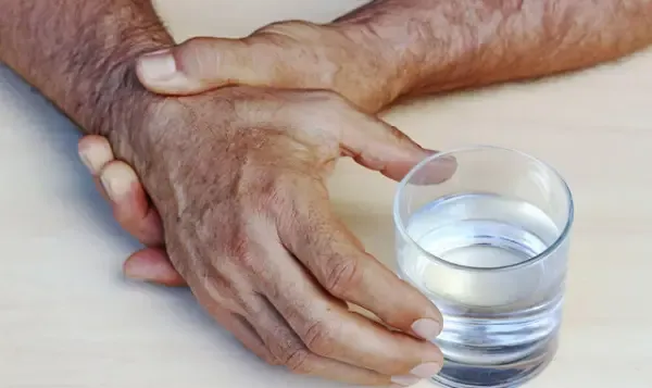 3 دلیل اصلی ابتلا به پارکینسون را بشناسیم 2 پارکینسون