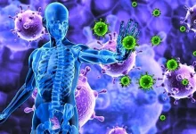 سندروم داون