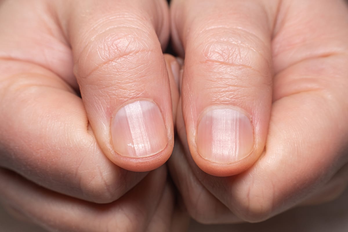 هاله ناخن‌ها