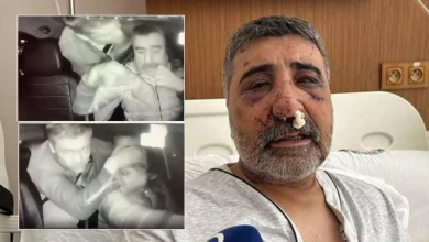 راننده تاکسی ترکیهای که توسط بوکسور انگلیسی بهشدت کتک خورد