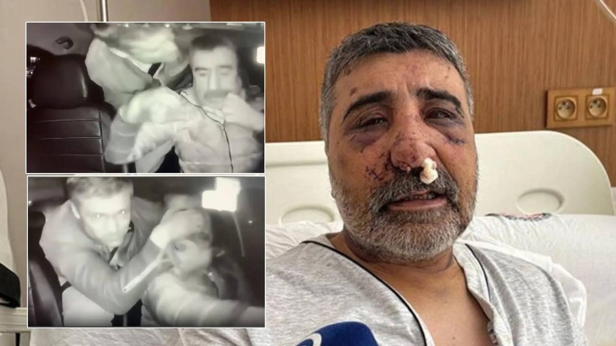 راننده تاکسی ترکیه‌ای که توسط بوکسور انگلیسی به‌شدت کتک خورد