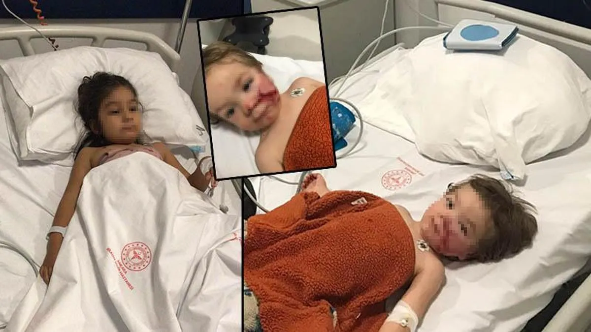 بازداشت صاحب سگ پیتبولی که در آنکارا دو کودک را مجروح کرد