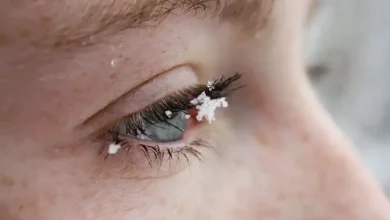 درمان خشکی چشم در زمستان1