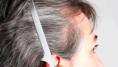 طب سنتی در مورد علت سفیدی مو چه می‌گوید؟